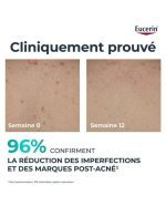 EUCERIN DERMOPURE CREME CORPS TRIPLE ACTION 200 ML – Image 5